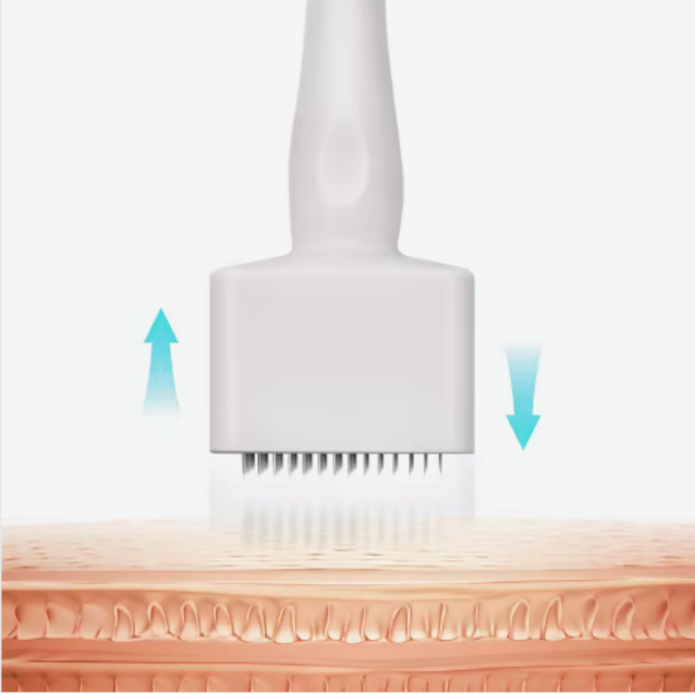 Dermaroller microneedle roller for anti-aging and facial skin therapy